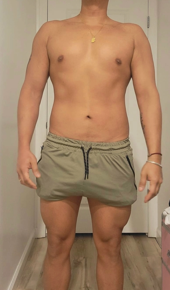Antes